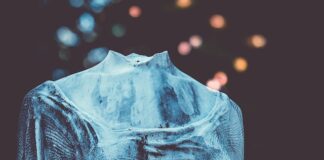 Czy można jeździć z uszkodzoną przekładnia kierownicza?